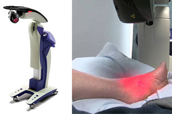 mls-laser-therapy